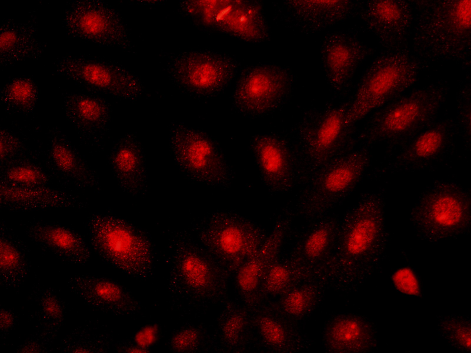 Immunofluorescence analysis of U-2OS cells using BRCA1 Polyclonal Antibody at dilution of 1:100