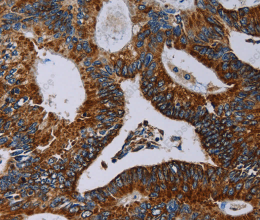 NDUFA4 Polyclonal Antibody - 2
