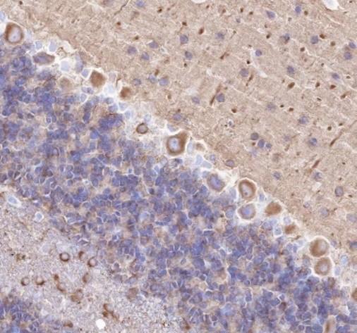 Recombinant alpha Tubulin (Acetyl K40) Monoclonal Antibody - small - 4