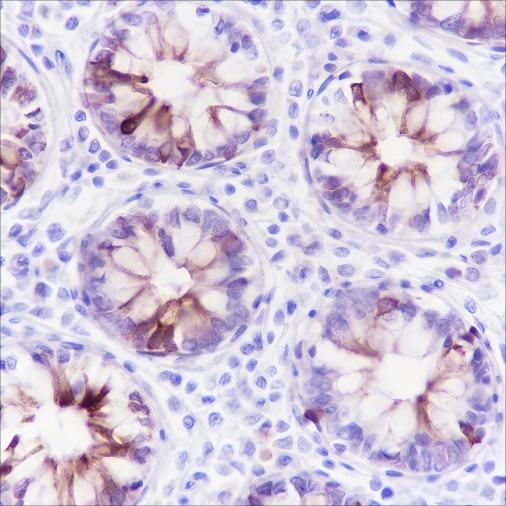 Recombinant MUC4 Monoclonal Antibody-searchlist-1