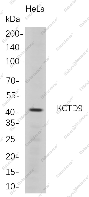 Recombinant KCTD9 Monoclonal Antibody - 1