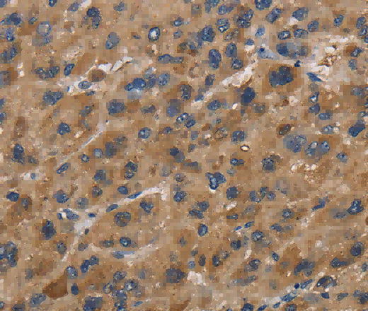 FABP2 Polyclonal Antibody - 2