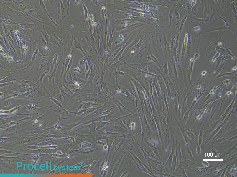 Mouse Pancreatic Stellate Cell Complete Medium - 3