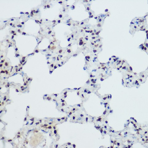 Immunohistochemistry of paraffin-embedded mouse brain using PLZF Polyclonal Antibody at dilution of 1:100 (40x lens).Perform high pressure antigen retrieval with 10 mM citrate buffer pH 6.0 before commencing with IHC staining protocol.