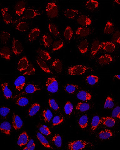 Confocal immunofluorescence analysis of U2OS cells using AP1M2 Polyclonal Antibody at dilution of 1:200. Blue: DAPI for nuclear staining.