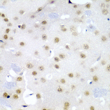 Immunohistochemistry of paraffin-embedded Mouse brain using CDC27 Polyclonal Antibody at dilution of 1:200 (40x lens).