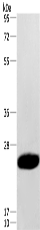 Western Blot analysis of Human fetal muscle tissue using CAV3 Polyclonal Antibody at dilution of 1:500