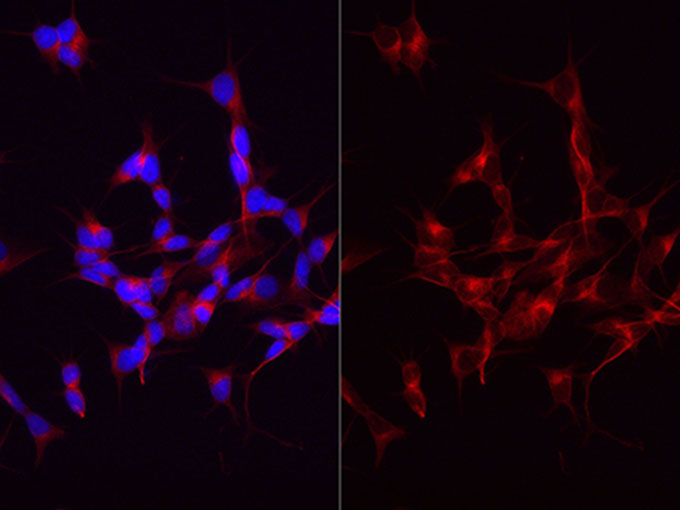 Immunofluorescent analysis of SHSY-5Y cells with anti-beta Tubulin Polyclonal Antibody at dilution of 1:2000.