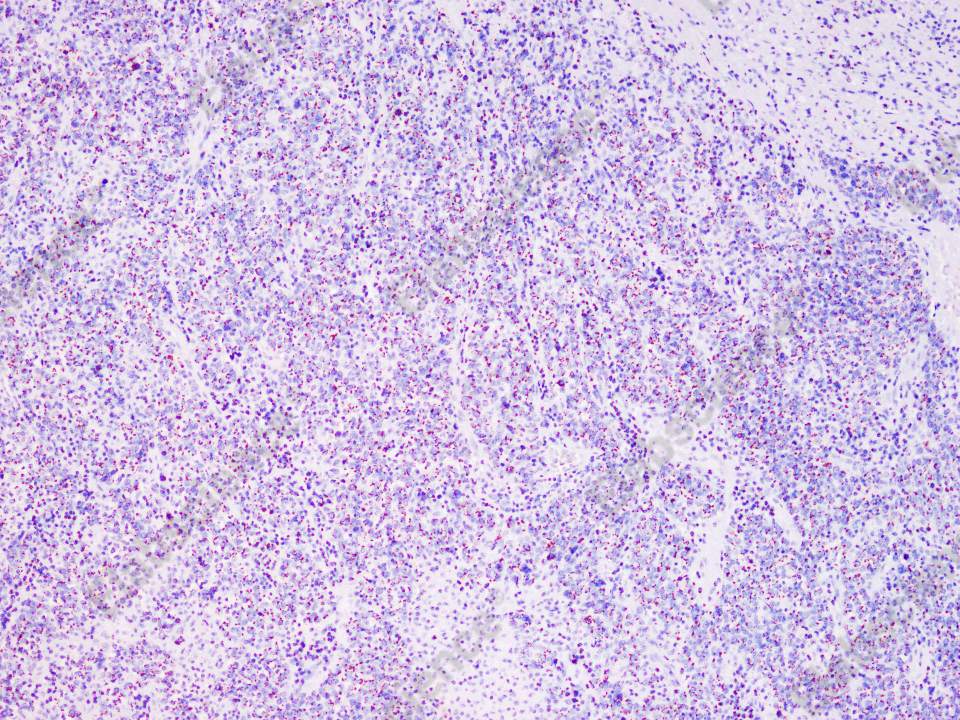 Recombinant ST6GAL1/ST6GAL-I Monoclonal Antibody - 1