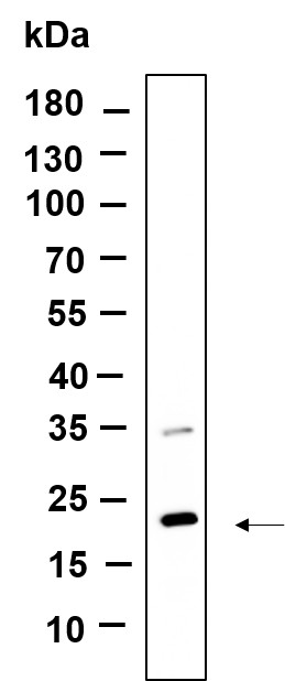 Recombinant CD81 Monoclonal Antibody-searchlist-1