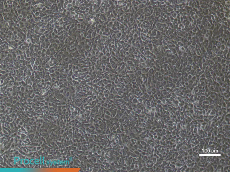 Mouse Pulmonary Microvascular Endothelial Cells (Primary cell immortalization)Mouse Pulmonary Microvascular Endothelial Cells (Primary cell immortalization) - 2