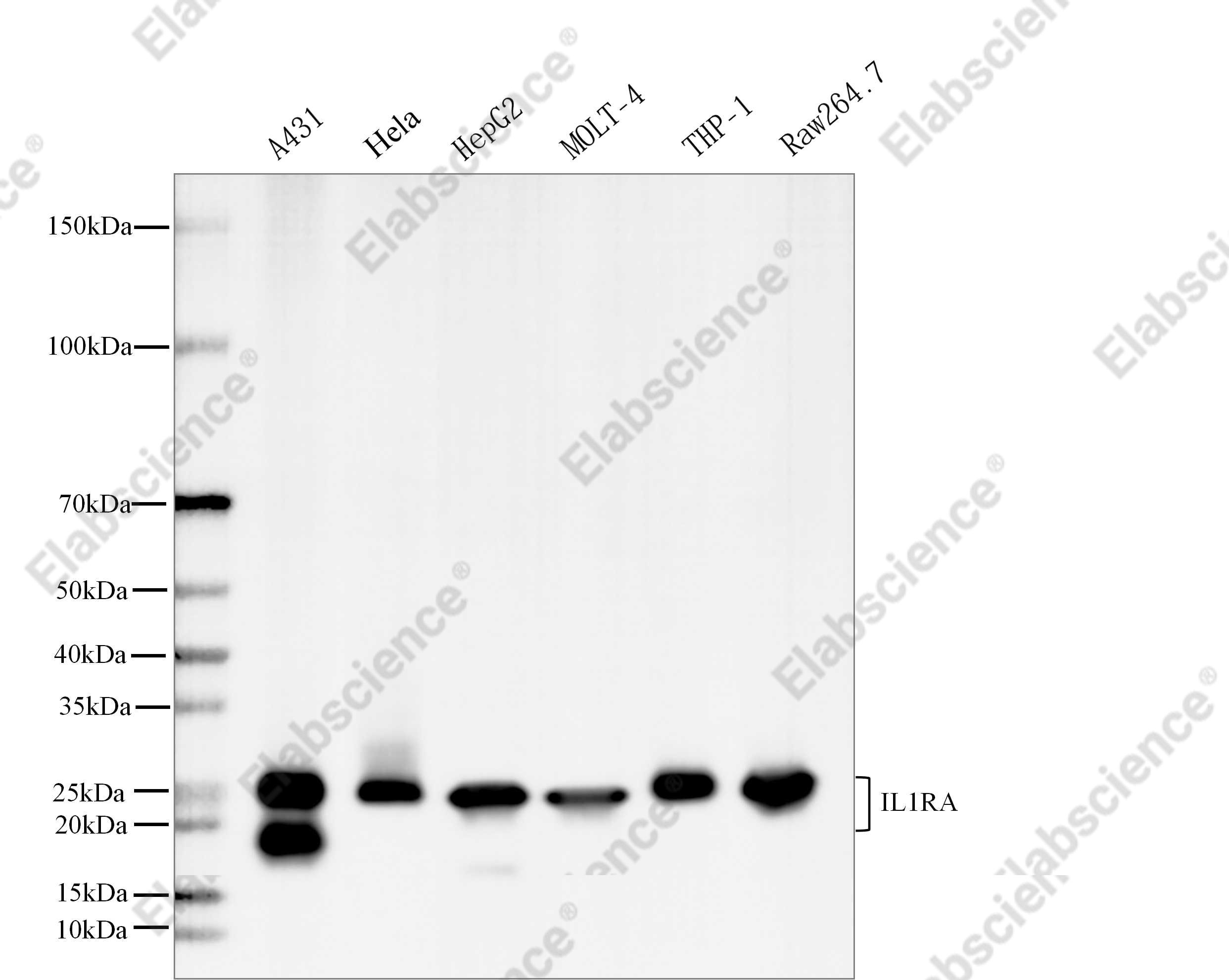 Recombinant IL-1RA/IL1RN Monoclonal Antibody - 2