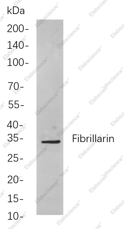 Recombinant Fibrillarin Monoclonal Antibody - 1