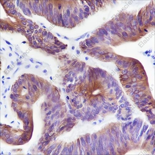 Recombinant Keratin 20 Monoclonal Antibody - 3