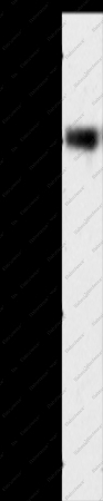 SLC32A1 Polyclonal Antibody - 1