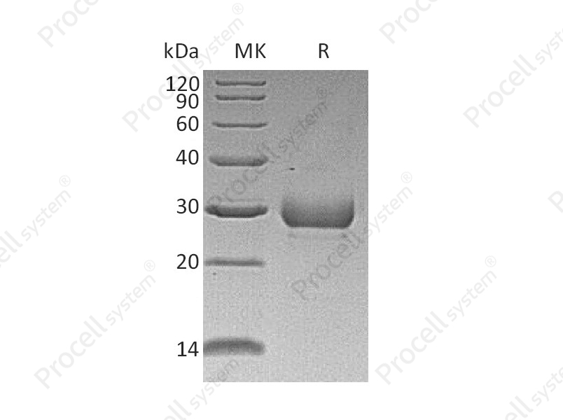 Noggin/NOG (N-8His-Flag), Human, Recombinant
