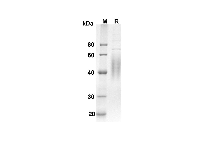 Recombinant Mouse IL7 Protein(Sumo Tag)-产品推荐-1
