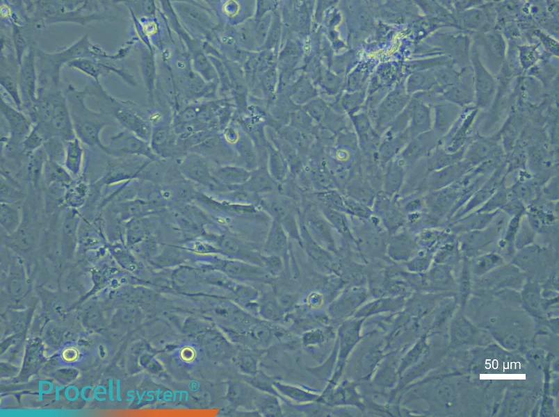 Rat Pulmonary Vascular Smooth Muscle Cell Complete Medium - 5