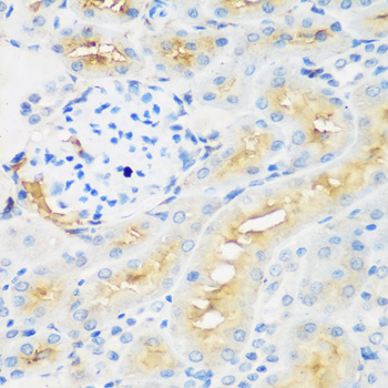 Immunohistochemistry of paraffin-embedded Rat kidney using PROCR Polyclonal Antibody at dilution of 1:200 (40x lens).