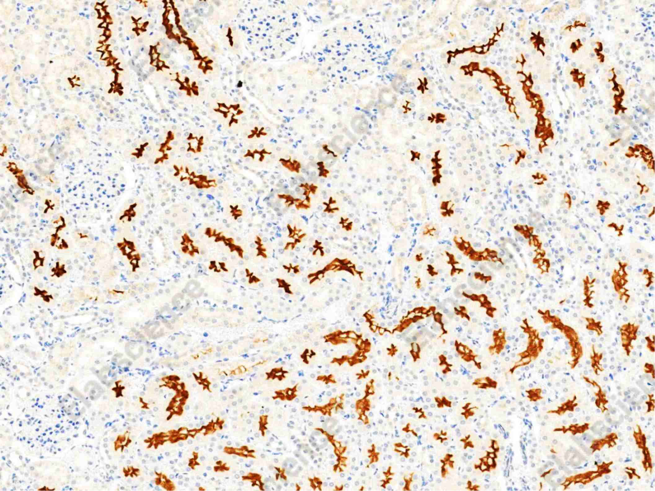 Recombinant Syndecan-1/SDC1 Monoclonal Antibody - 3