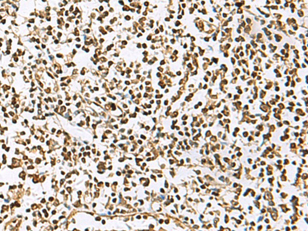 Immunohistochemistry of paraffin-embedded Human tonsil tissue  using UBLCP1 Polyclonal Antibody at dilution of 1:85(?200)