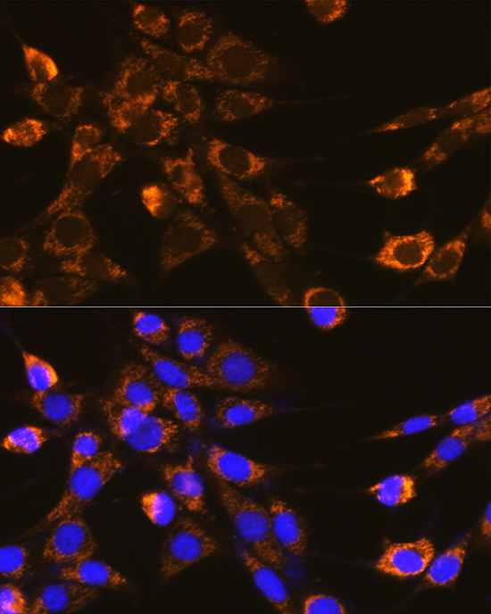 Immunofluorescence analysis of NIH-3T3 cells using Integrin-β1/CD29 Polyclonal Antibody at dilution of 1:100 (40x lens). Blue:DAPI for nuclear staining.