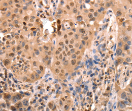 ACO2 Polyclonal Antibody - 3
