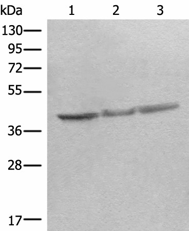 Western blot analysis of Mouse brain tissue Rat heart tissue Rat brain tissue lysates  using STOML2 Polyclonal Antibody at dilution of 1:350