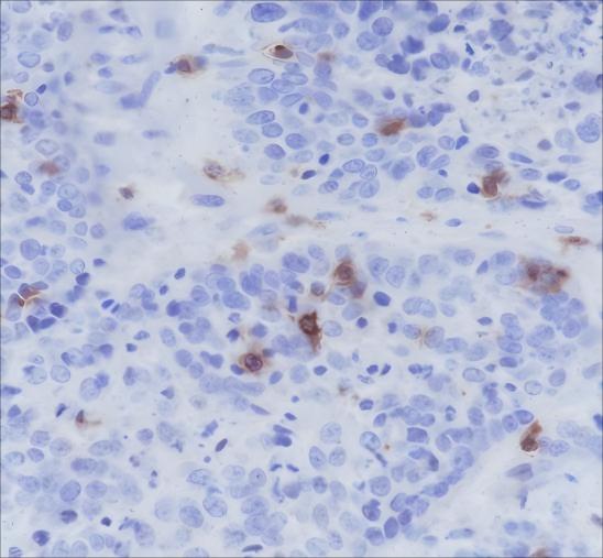 Recombinant CD103 Monoclonal Antibody - 2