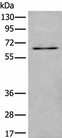 Western blot analysis of SKOV3 cell lysate  using UBQLN2 Polyclonal Antibody at dilution of 1:500