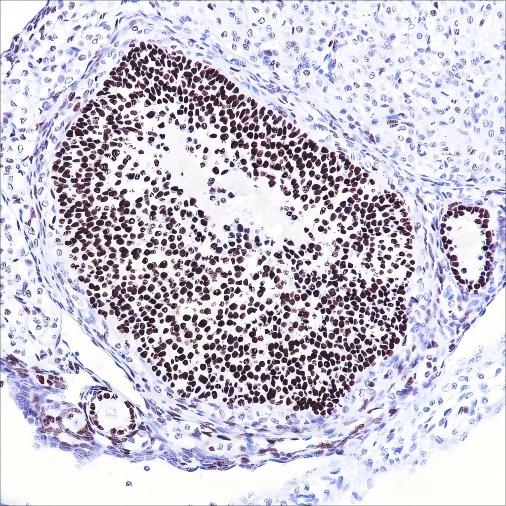 Recombinant FOXL2 Monoclonal Antibody - 3