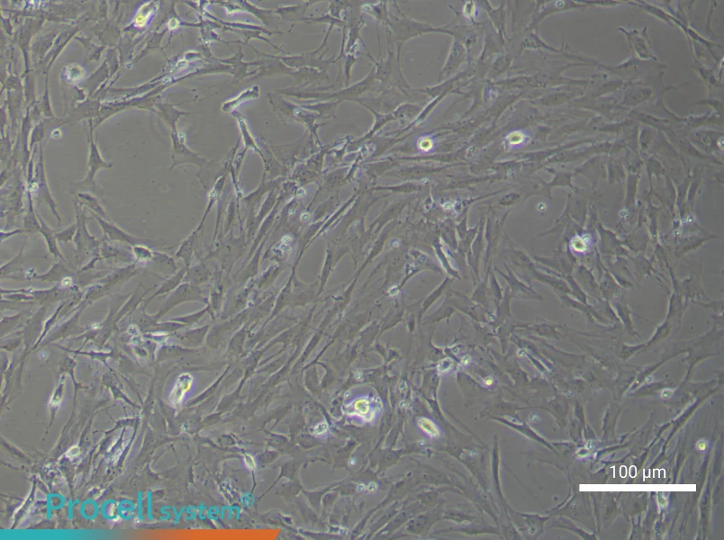 Rat Brain Microvascular Pericyte Complete Medium - 2