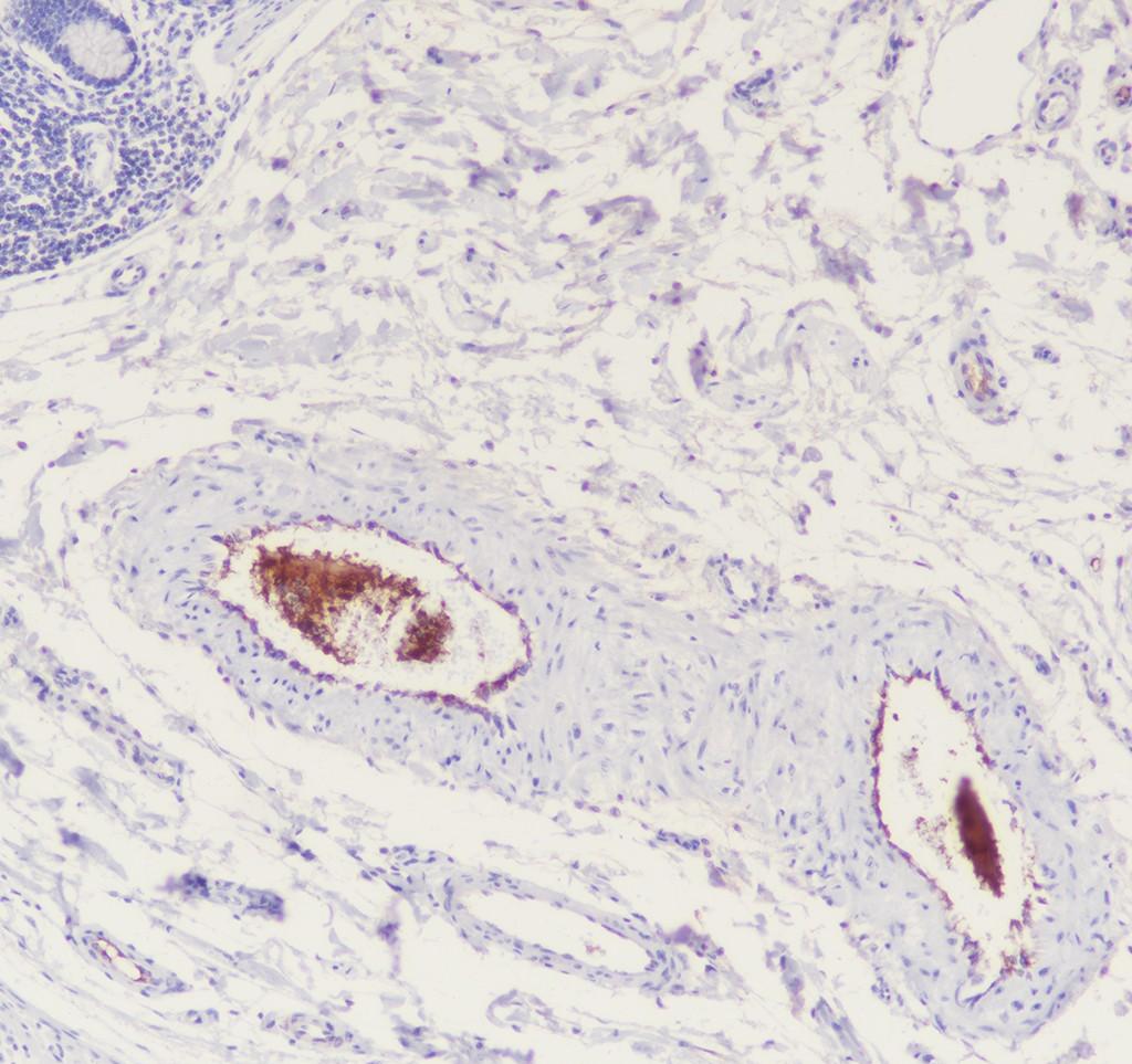 Recombinant C5 Monoclonal Antibody - small - 2