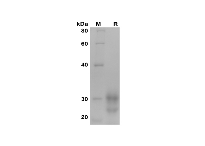 Recombinant Human IL-7 Protein-1