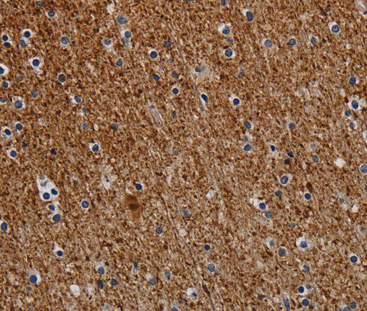 Immunohistochemistry of paraffin-embedded Human brain  tissue using DCAF6 Polyclonal Antibody at dilution 1:30