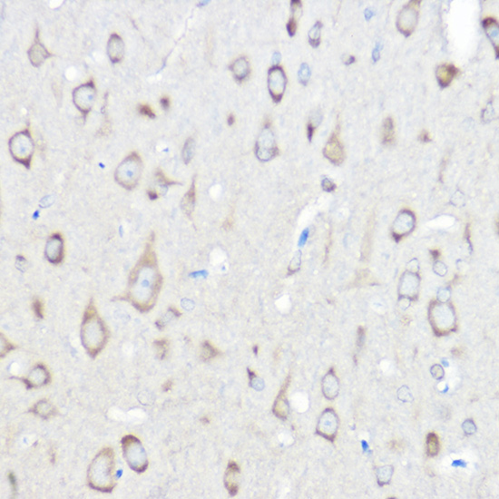 Immunohistochemistry of paraffin-embedded rat brain using SARS Polyclonal Antibody at dilution of 1:100 (40x lens).Perform high pressure antigen retrieval with 10 mM citrate buffer pH 6.0 before commencing with IHC staining protocol.