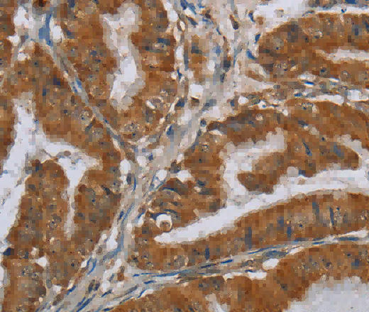 CSH1 Polyclonal Antibody - 3