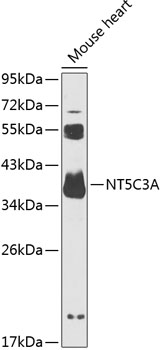 Western blot analysis of extracts of mouse brain using NT5C3A Polyclonal Antibody at 1:1000 dilution.