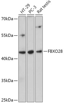 Western blot analysis of extracts of various cell lines using FBXO28 Polyclonal Antibody at 1:1000 dilution.