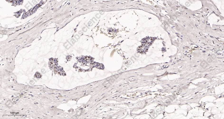 Recombinant Rad21 Monoclonal Antibody - 2