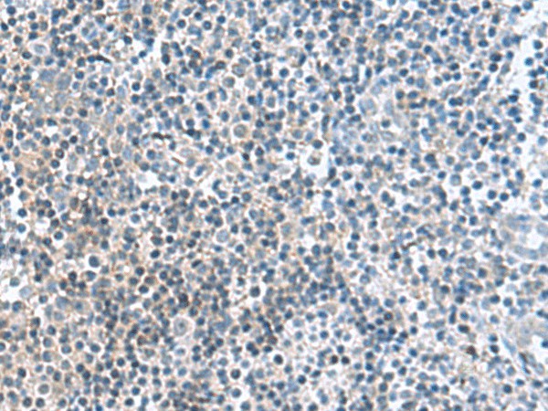 Immunohistochemistry of paraffin-embedded Human tonsil tissue  using FAM107B Polyclonal Antibody at dilution of 1:160(?200)