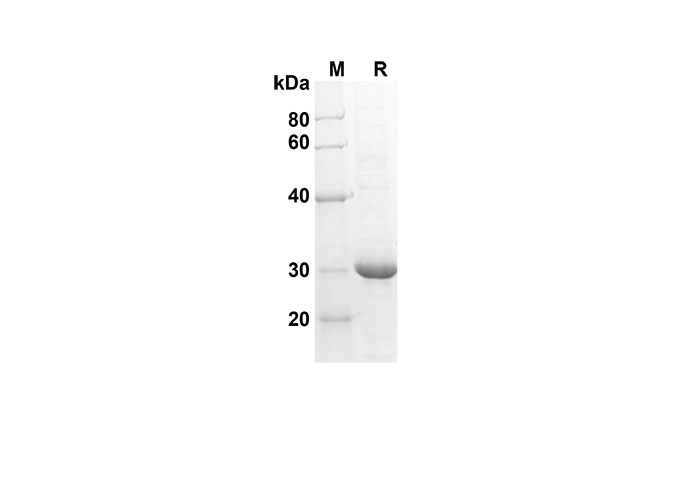 Recombinant Rat CD48 Protein(Fc Tag)-产品推荐-1