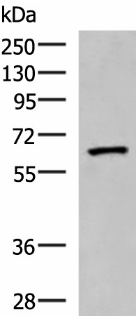 Western blot analysis of Human placenta tissue lysate  using PDIA5 Polyclonal Antibody at dilution of 1:1000