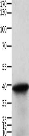 Western Blot analysis of Human cervical cancer tissue using TPM2 Polyclonal Antibody at dilution of 1:600