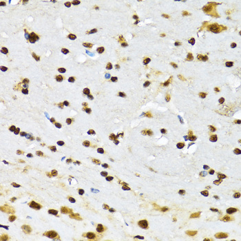 Immunohistochemistry of paraffin-embedded mouse brain using CCAR2 Polyclonal antibody at dilution of 1:100 (40x lens).Perform microwave antigen retrieval with 10 mM PBS buffer pH 7.2 before commencing with IHC staining protocol.