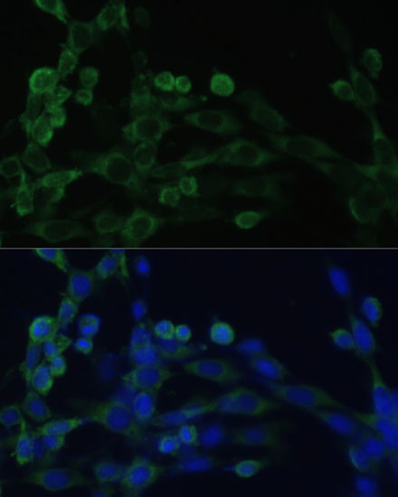 Immunofluorescence analysis of NIH/3T3 cells using EEF1B2 Polyclonal Antibody at dilution of  1:100. Blue: DAPI for nuclear staining.