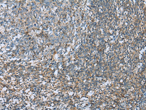DCX Polyclonal Antibody - small - 2
