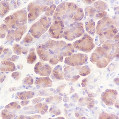 Recombinant ATG4B Monoclonal Antibody - 3