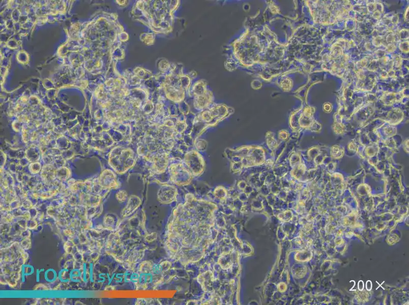 KM12 Cell Complete Medium - 5