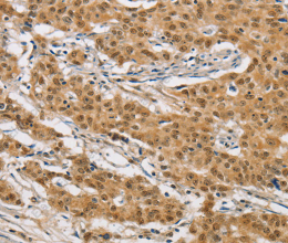 ARHGAP25 Polyclonal Antibody - 2